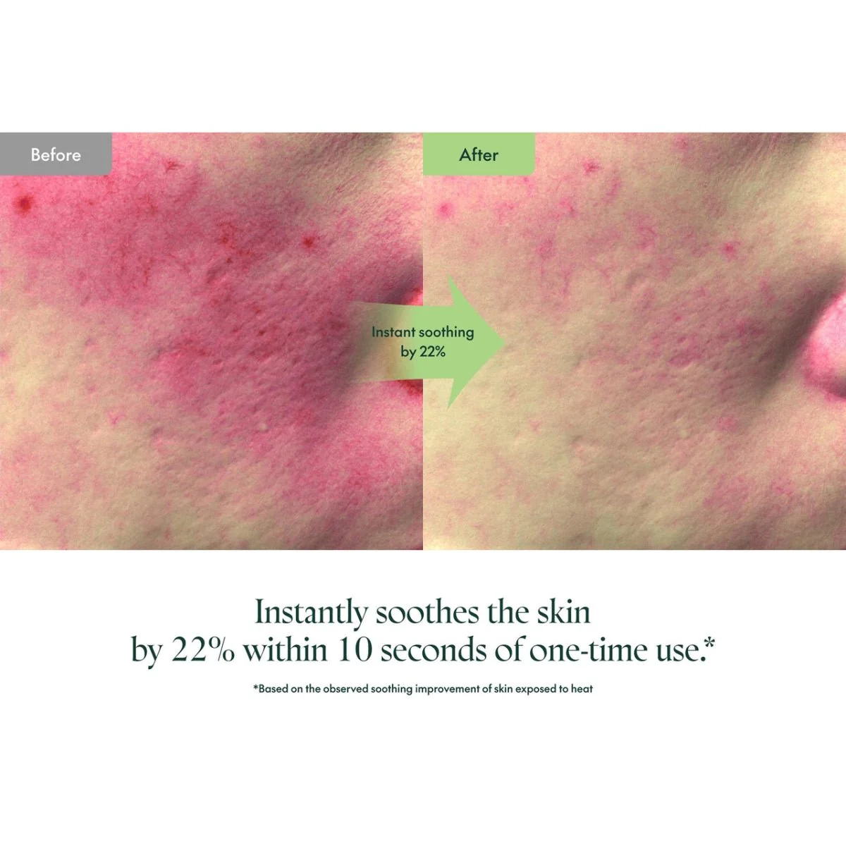Wonder Releaf Centella Serum Unscented - Image 6